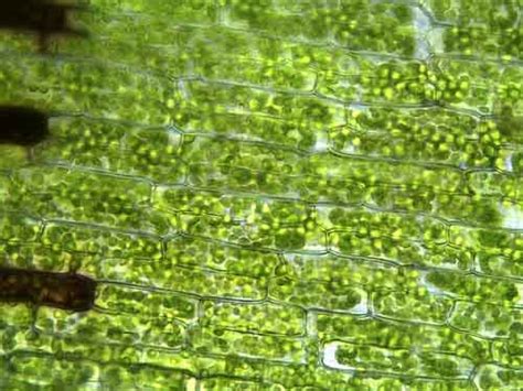 Elodea Leaf Under Microscope 40x Labeled | Leafandtrees.org