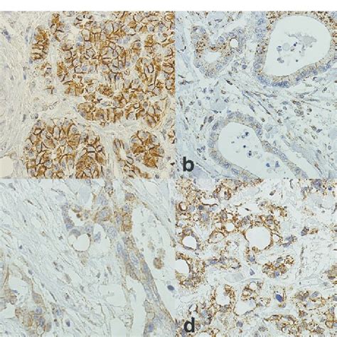 Immunohistochemical Staining Pattern Of β Catenin In Normal Pancreas Download Scientific