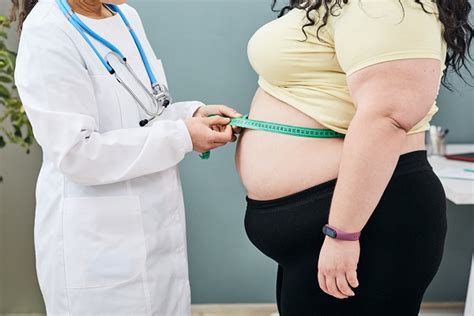 El Problema De Obesidad En Estados Unidos Gu A