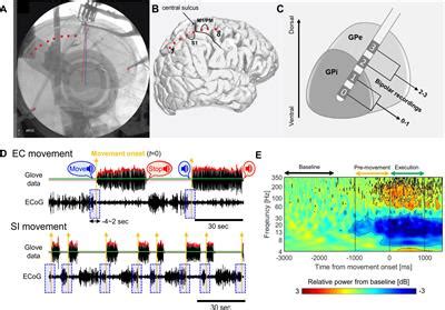 Frontiers Altered Pallidocortical Low Beta Oscillations During Self