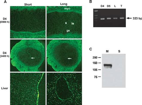 Analysis Of Expression Of Soluble LIFR And Gp130 In The Mouse Uterus