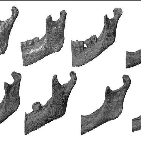 View Of A Lateral Mandibular Condyle A Mandibular Area And B Download Scientific Diagram