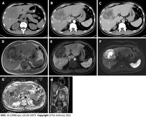 Preoperative Computed Tomography And Magnetic Resonance Imaging Images Download Scientific