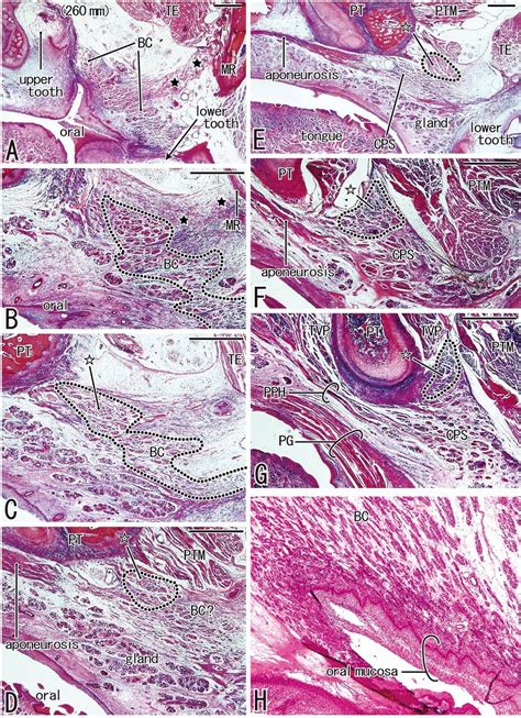 Constrictor Pharyngis Superior And Palatopharyngeus Seen In Frontal