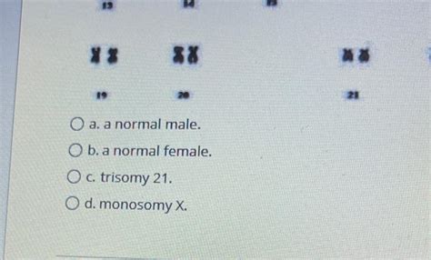 Solved Question The Individual Karyotype Shown Below Is An Chegg