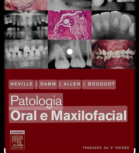 Livro Patologia Oral E Maxilofacial Livro Elsevier Usado