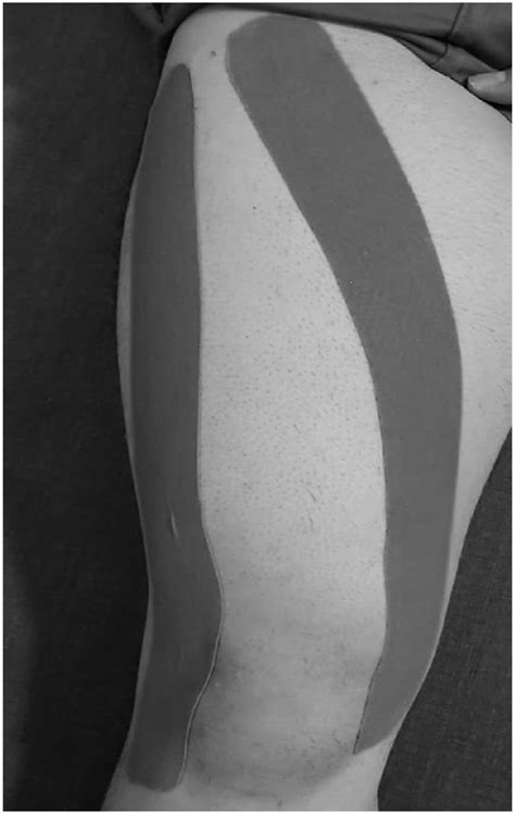 Immediate Effects Of Kinesiology Tape On Quadriceps Muscle Peak Torque