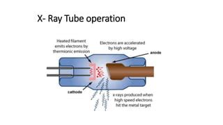 Fluoroscopy ,Radiation safety and contrast agents including adverse ...