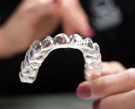 Braces Vs Clear Aligners How To Know Which One Is Best For You