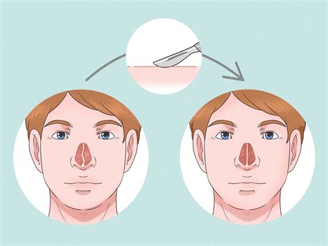 how to keep your mouth closed while sleeping 6