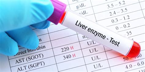 Interpreting Liver Enzyme Tests: ALT, AST, and ALP in Liver Health ...