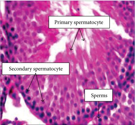 The Histological Examination Of Both Testicular And Epididymal Tissues