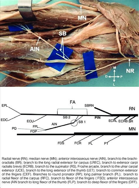 Transfer Of The Branches Of The Supinator Sb To Reinerve The