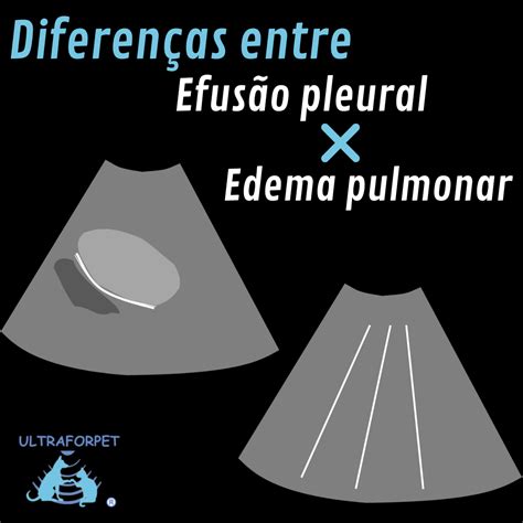 Efus O Pleural X Edema Pulmonar Na Avalia O Tor Cica Ultraforpet