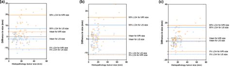 Breast Cancer Research And Treatment Reconstruction Of Unilateral