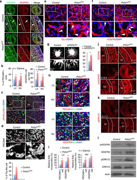 POFUT1 Regulates Angiogenic Functions And Proliferation Of Coronary