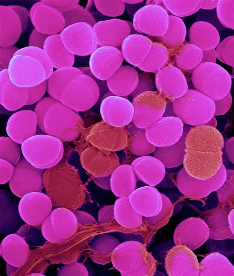 Staphylococcus Haemolyticus Photograph By Dennis Kunkel Microscopy