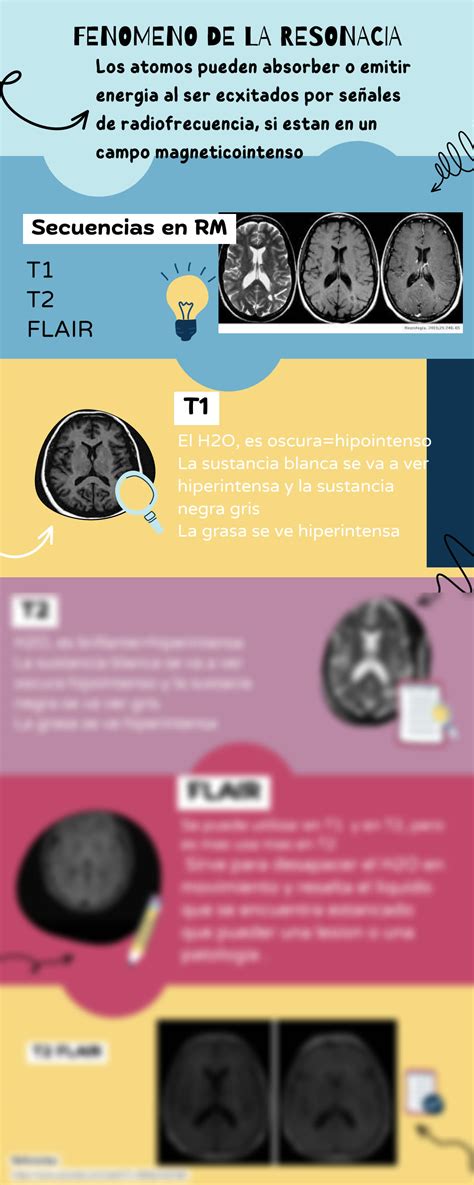 SOLUTION Resonancia Magnetica Espacio K Studypool