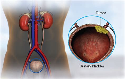 Health Condition : Symptoms, Causes, Treatment and More