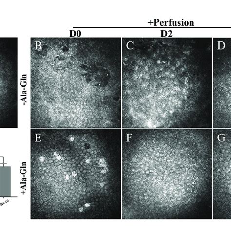 Evaluation Of The Morphology And Density Of Corneal Endothelial Cells Download Scientific