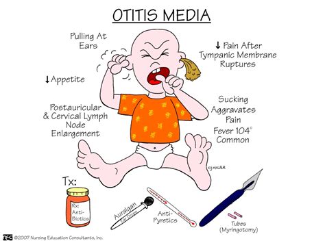 Med-Surg Picture Mnemonics - Digital Nurse's Station