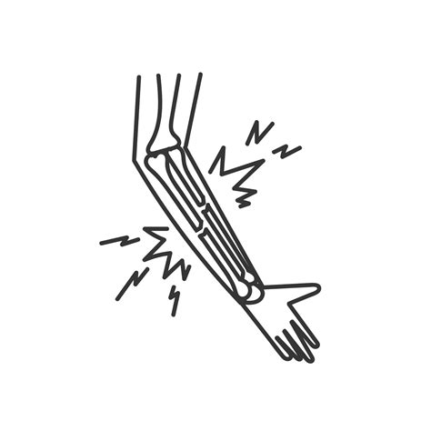 a hand with a bone sticking out of it fractured 50575461 Vector Art at