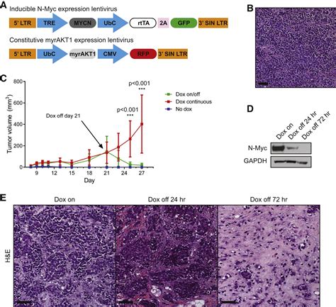 N Myc Drives Neuroendocrine Prostate Cancer Initiated From Human