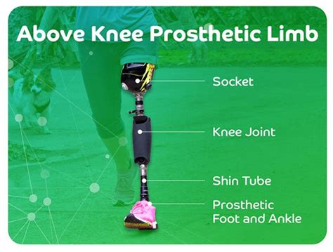 Above Knee Prosthetic Limbs