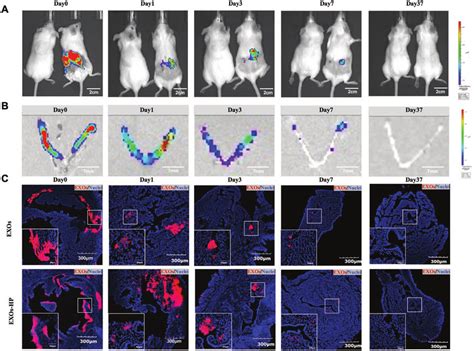 Hp Promoted The Retention Of Exos In The Endometrium Of Iua Mice A