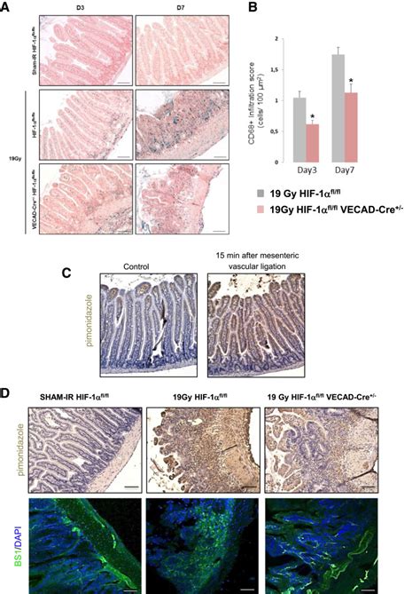 HIF 1α Deletion in the Endothelium but Not in the Epithelium Protects