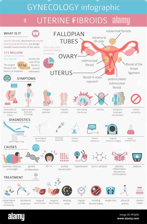 Los Fibroides Uterinos Ginecological Enfermedad Médica En Mujeres Infográfico Ilustración