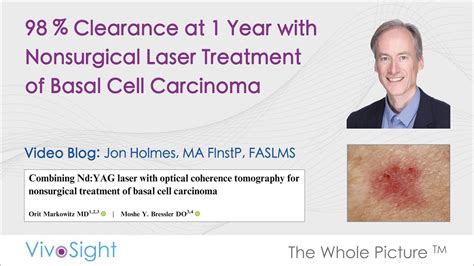 Oct Guided Laser Treatment Of Basal Cell Carcinoma Oasis Medical Aesthetics