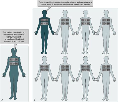 Solid Organ Transplantation Clinical Gate