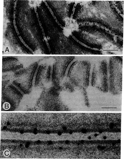 Immunoelectron Microscopic Localization Of The Kda Protein A