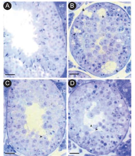 Figure 1 From A Comprehensive Review Of Male Reproductive Toxic Effects