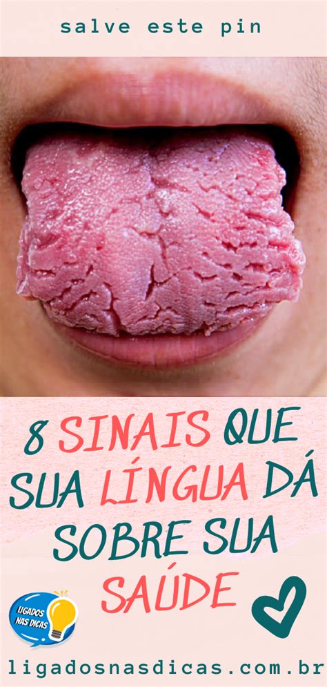 8 Sinais Que Sua Língua Dá Sobre Sua Saúde Saúde Dicas De Saúde