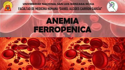 Anemia Ferrop Nica Milk Cuellar Udocz