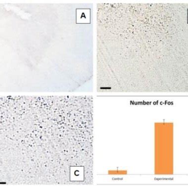 Photomicrographs Showing The Expression Of C Fos Protein In The Dorsal