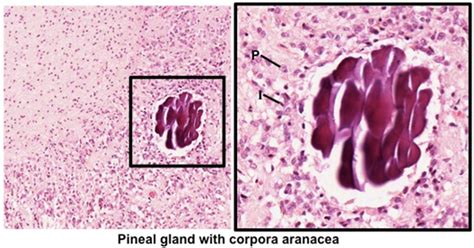 Pineal Gland Histology Labeled