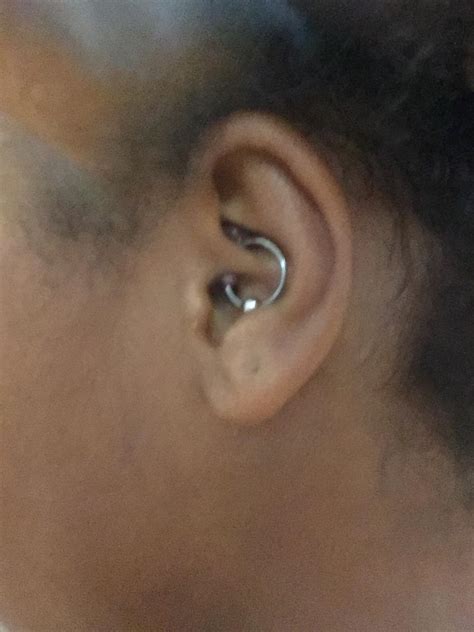 So This Is My Daith Its About 6 Weeks Old And Has These Bumps How Do