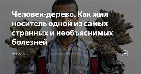 Человек-дерево. Как жил носитель одной из самых странных и необъяснимых ...