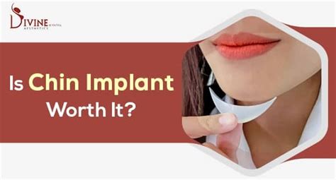 Chin Implant Surgery : How It Works , Pros And Cons & Recovery