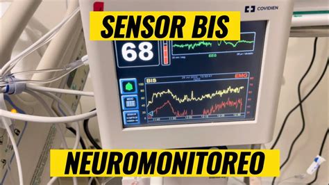 Sensor Bis Monitorizacion Neurologica Youtube