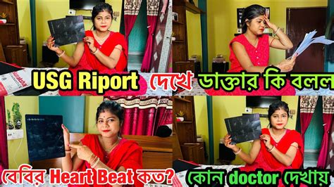 আমার বেবির Heart Beat কত Usg রিপোর্ট দেখে ডাক্তার এমন কি বললযে