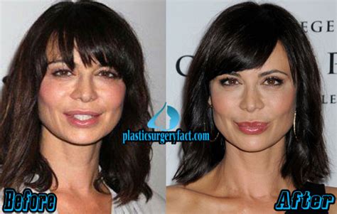 Catherine Bell Plastic Surgery Before and After Photos