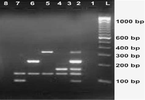 Electrophoresis Profile In 2 Agarose Gel Showing Multiplex Pcr