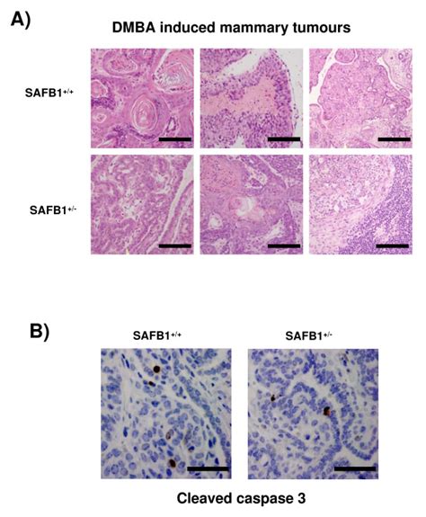 Histological Evaluation Of Dmba Induced Tumors Of Different Safb1