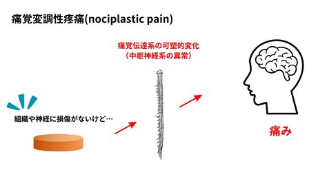 痛みの基礎② 痛みの分類