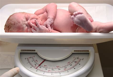 Complications Associated With Babies Born at 36 Weeks