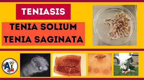 TENIASIS Taenia Solium Y Saginata YouTube